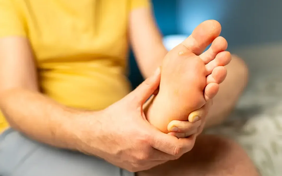 Uncomfortable Plantar Warts: Causes, Symptoms, and Treatment Tips