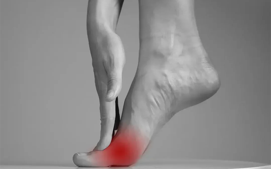 Symptoms of Morton’s Neuroma to Watch For