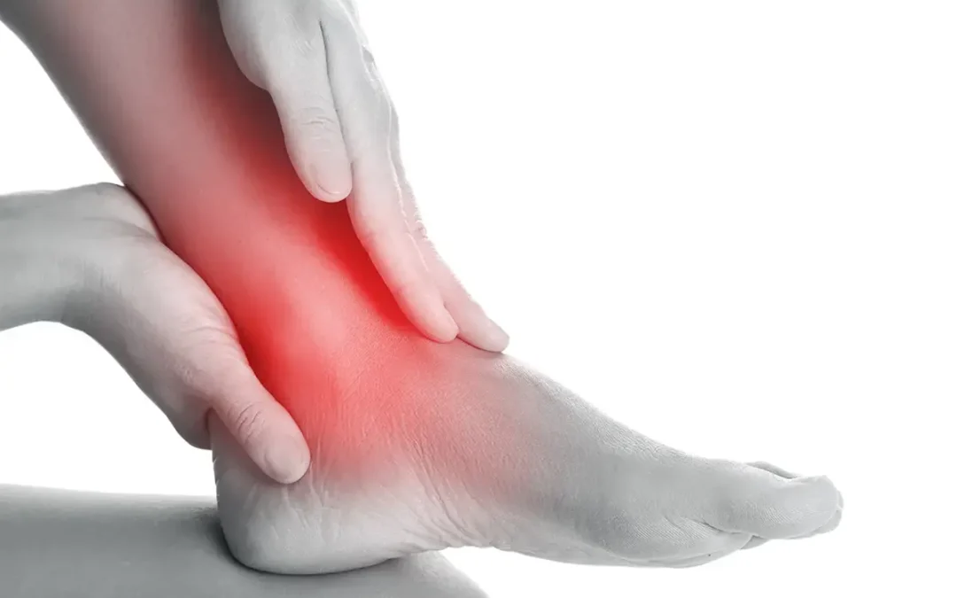 Different Types of Ankle Sprains and How to Identify Them