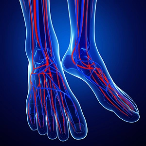 Poor circulation foot illustration